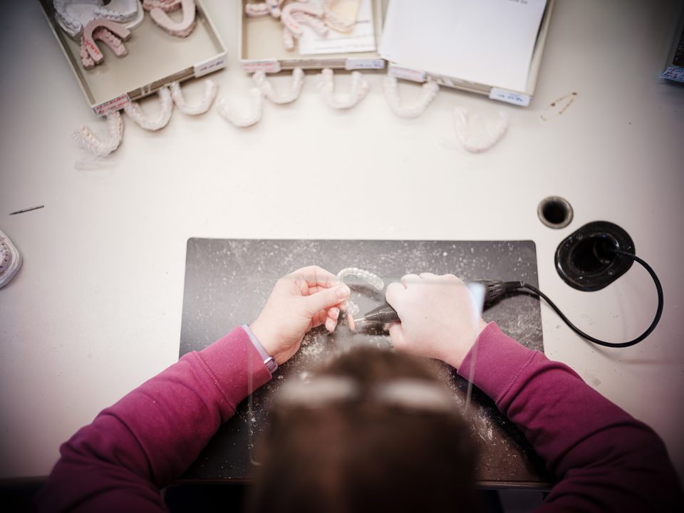 Nahaufnahme der Handarbeit an einer transparenten Alignerschiene unter der Lupenlampe